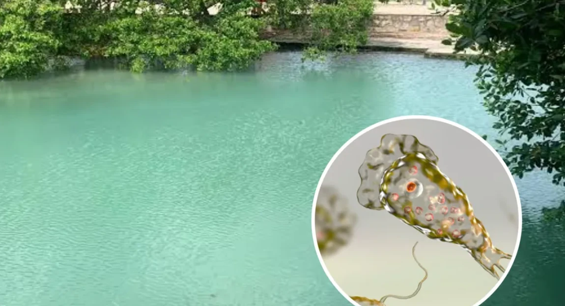 Clausuran Lagos Artificiales en Mérida por Presencia de Ameba Come Cerebros